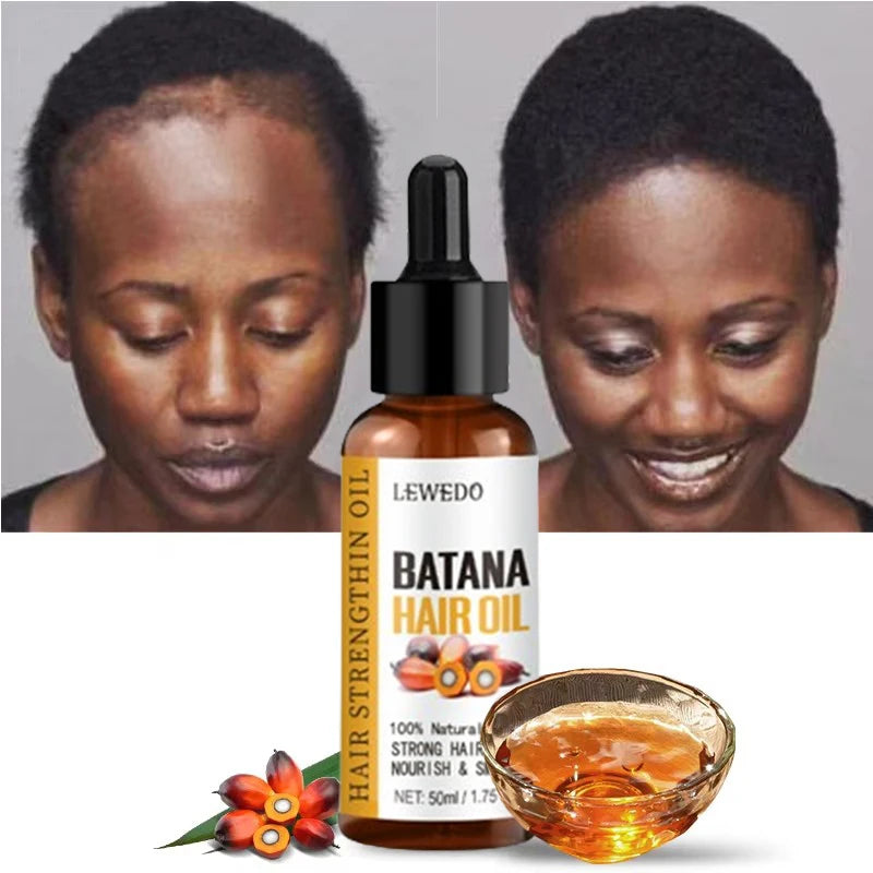 Lewedo Naturals Batana Oil Fast Hair Growth for Men Women